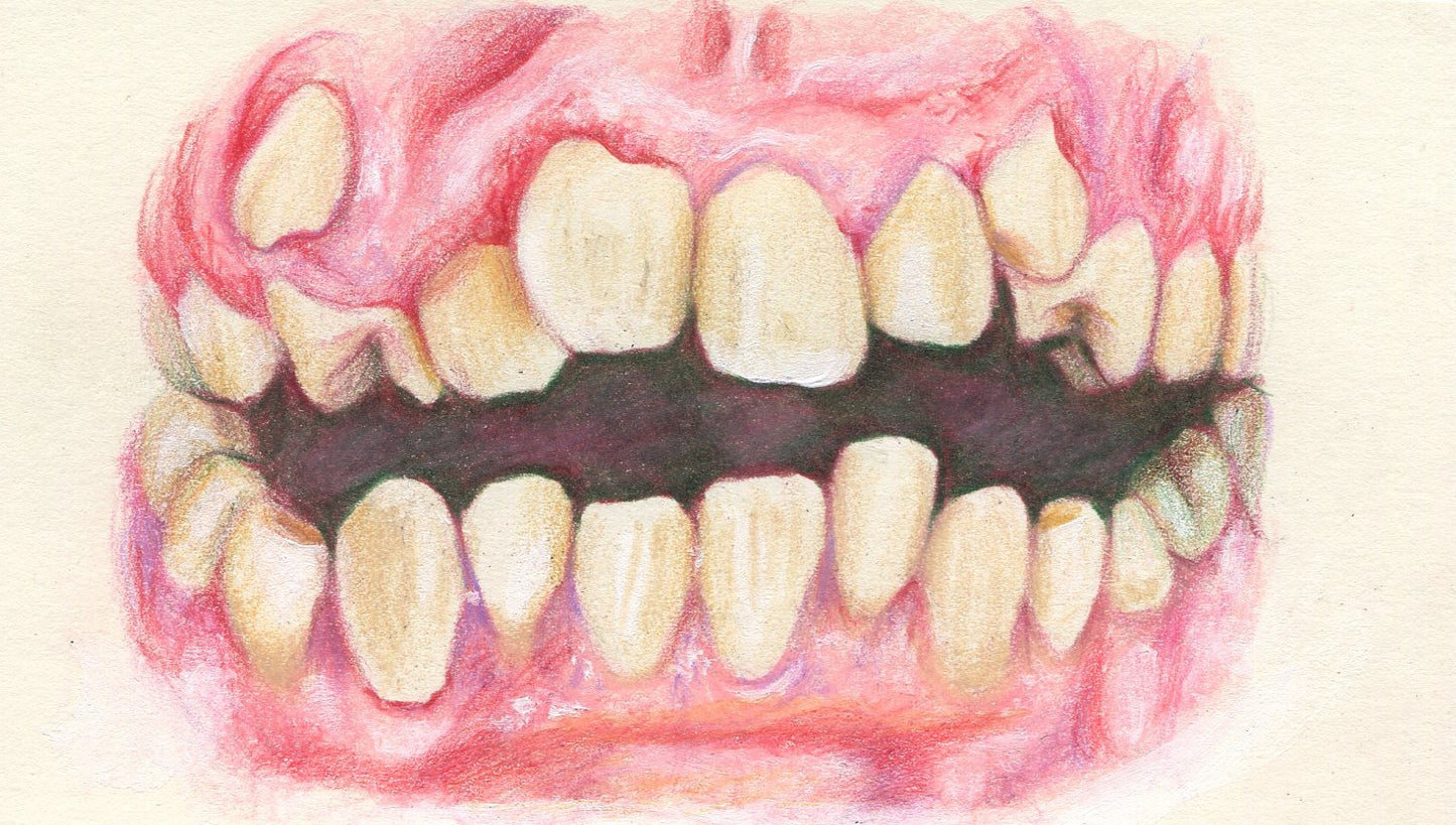 Teeth Print Framed